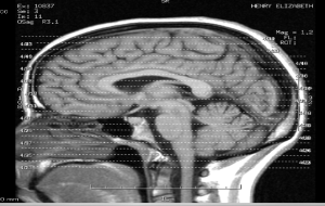 my brains - let me show you them